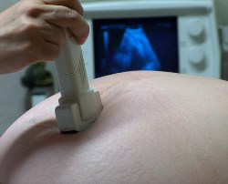 Divide CO sonographer performing ultrasound